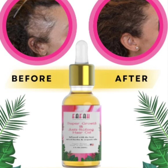 The Fafah Super Growth & Anti-Itching Hair Oil ( 2 oz) - Picture 2 of 10